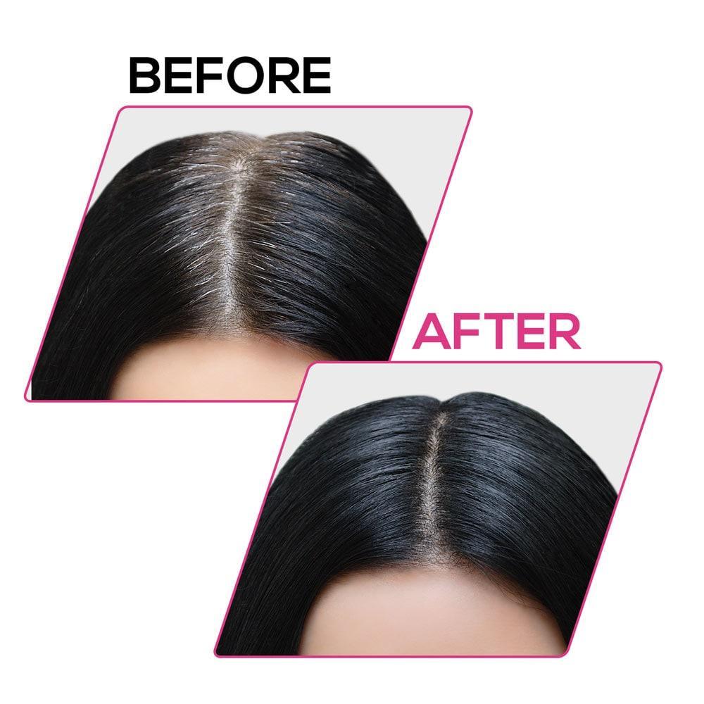 RENEE Cover Up Hair Powder, 4g