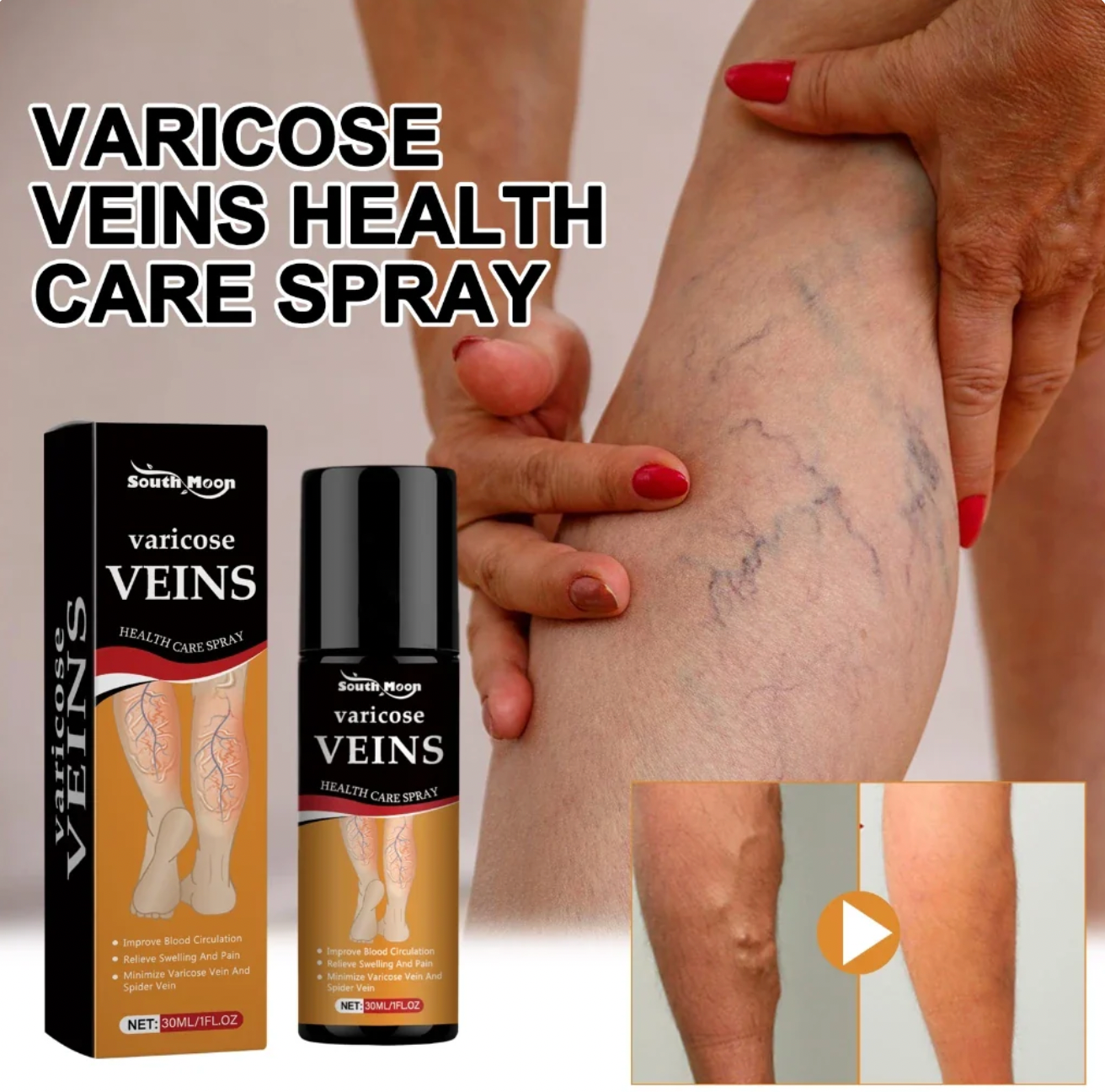 Richavita™ Varicose Veins  Spray
