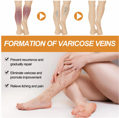 Richavita™ Varicose Veins  Spray