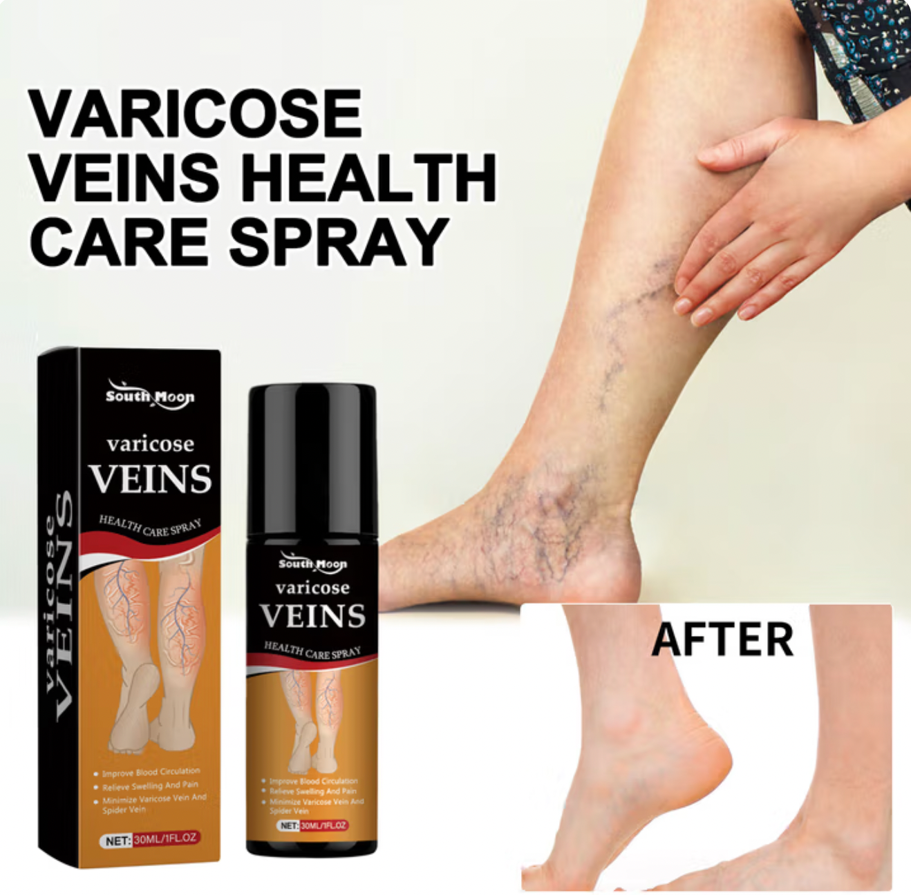 Richavita™ Varicose Veins  Spray
