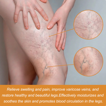 Richavita™ Varicose Veins  Spray